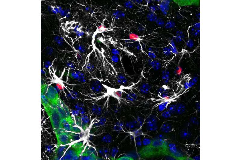 **A new therapy proves effective against brain metastasis