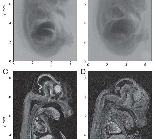 Researchers report micro-CT scan of a mouse embryo at unprecedented resolution