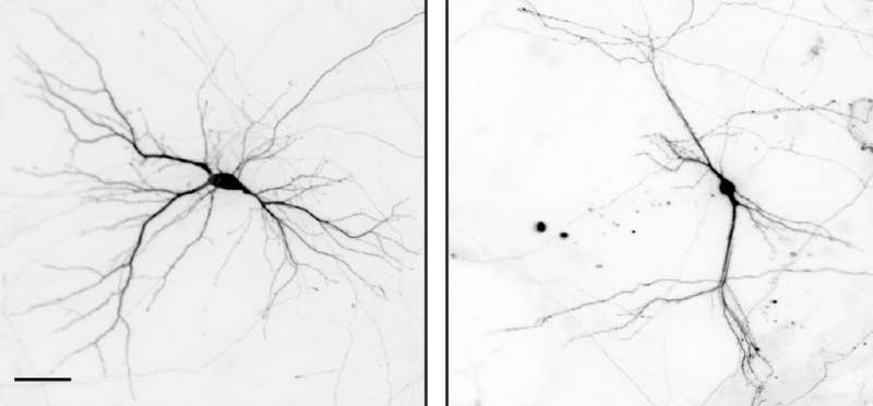 New regulator of neuron formation identified
