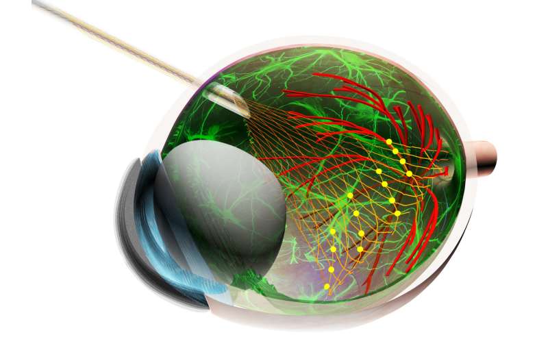 Injectable electronics offer powerful new tool in understanding how retinal cells work