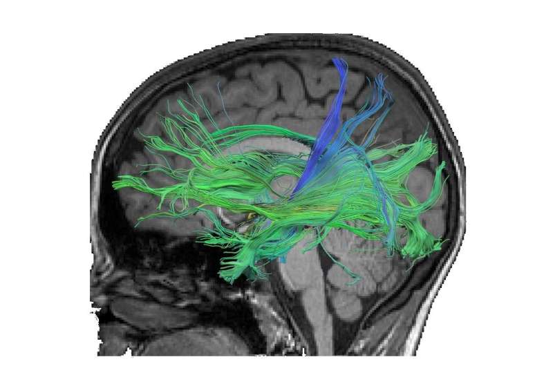 Better connectivity of brain regions with training