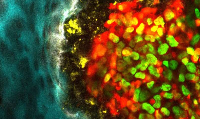 Microscopic imaging pierces the 'black box' of cancer bone metastasis