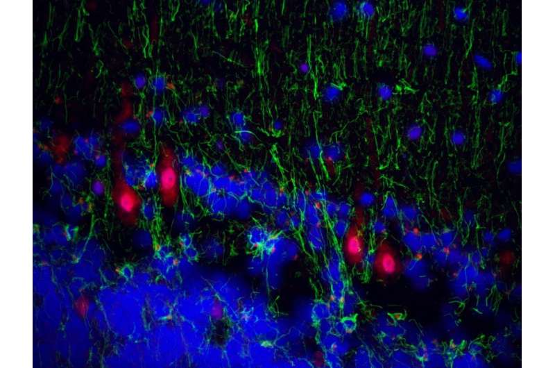 Surprise finding in neurons