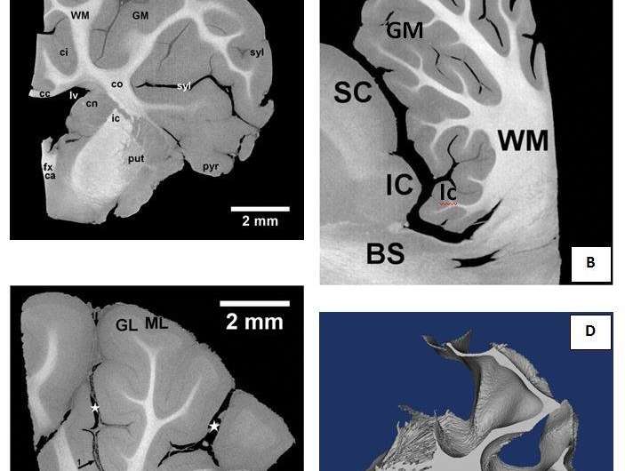 New technique to visualise brain tissue