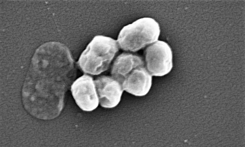Study shows bacteria change their surfaces to increase antibiotic resistance