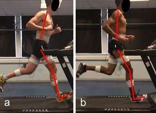 How poor technique contributes to majority of running injuries