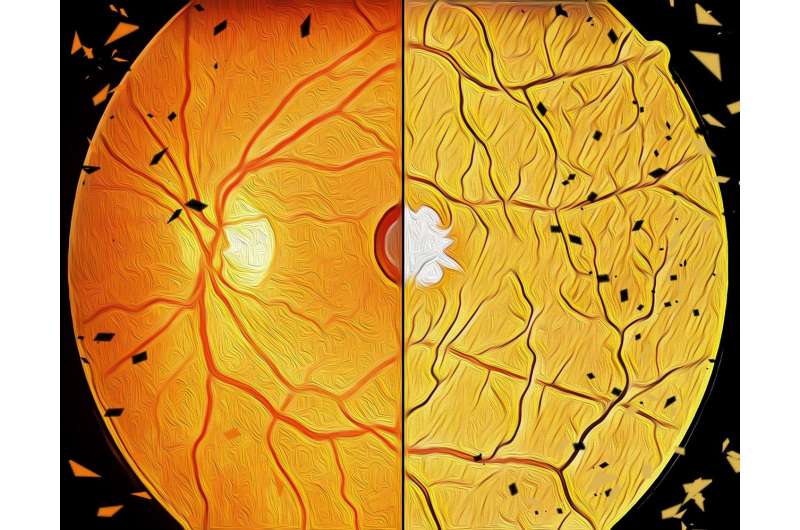 Pathomechanisms deciphered for the two most common age-related eye disorders