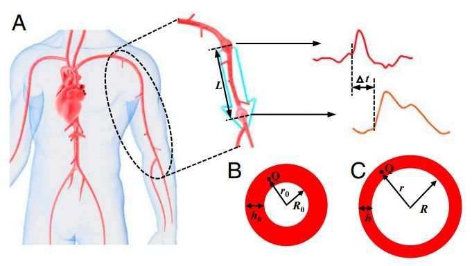 New model suggests cuffless, non-invasive blood pressure monitoring possible using pulse waves