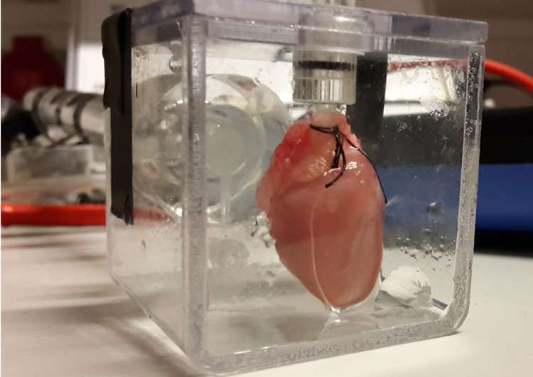 Scientists figure out how to measure electrical activity in a fetal heart