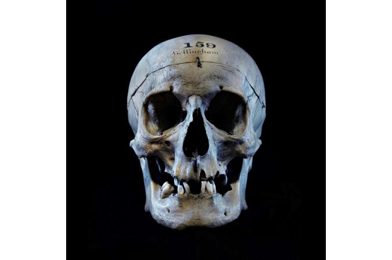 Revealing the face of an infamous 19th century British assassin from a skull