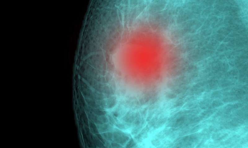 Breast cancer researcher warns against online genetic tests