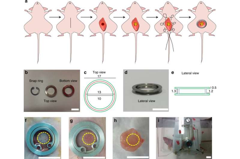 Genetically engineered 3D human muscle transplant in a murine model