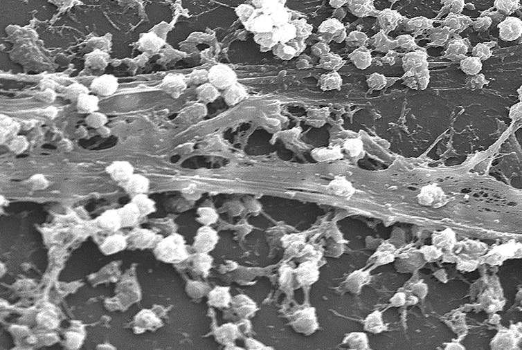 How scientists are fighting infection-causing biofilms