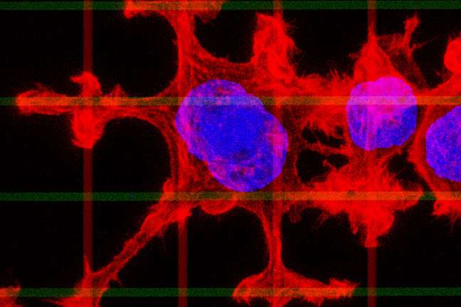 Researchers stop 'sneaky' cancer cells in their tracks