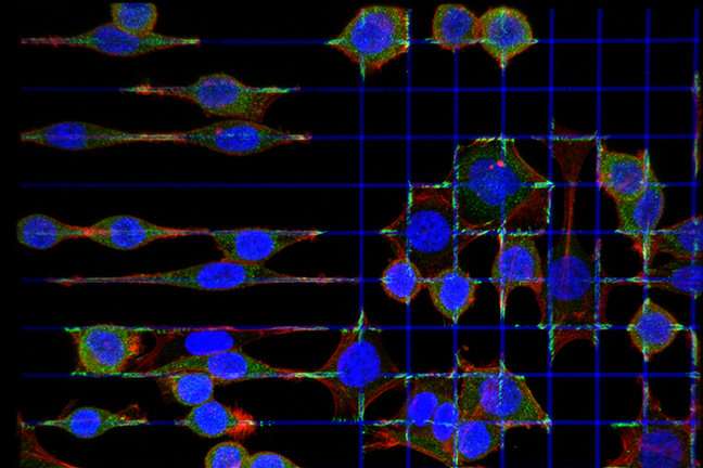 Researchers stop 'sneaky' cancer cells in their tracks