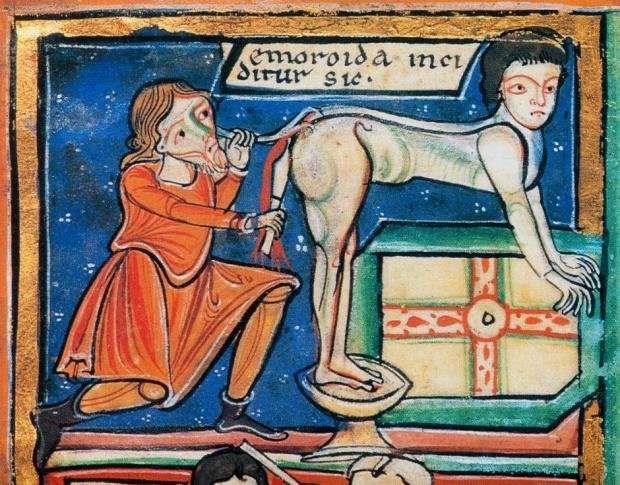 Everything you ever wanted to know about the history of haemorrhoids