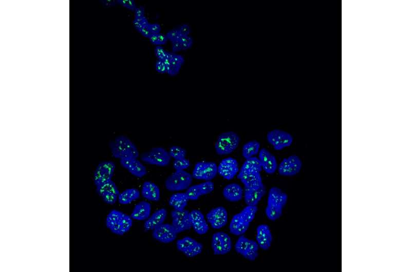研究人员发现了一种使转移性乳腺癌细胞处于休眠状态的蛋白质