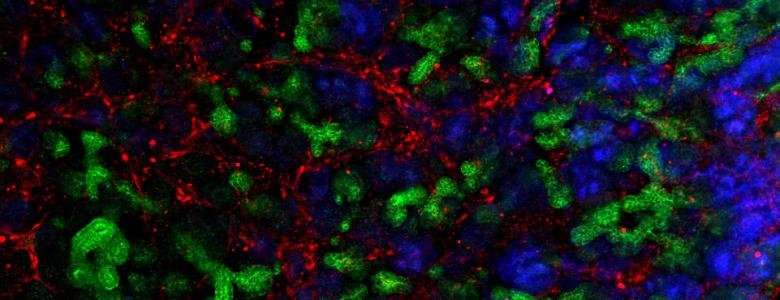 Researchers move one step closer towards functioning kidney tissue from stem cells