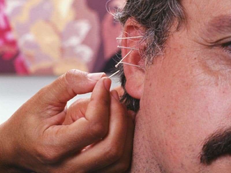 Acupuncture: A new look at an ancient remedy
