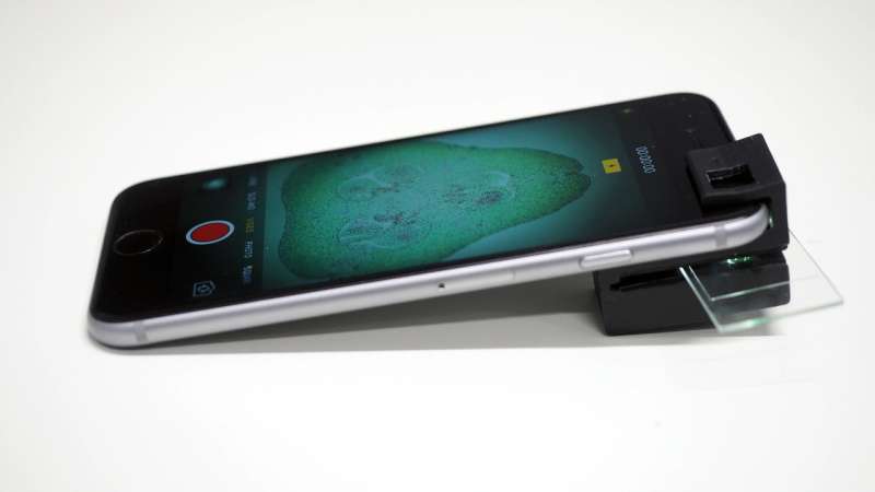 Add-on clip turns smartphone into fully operational microscope