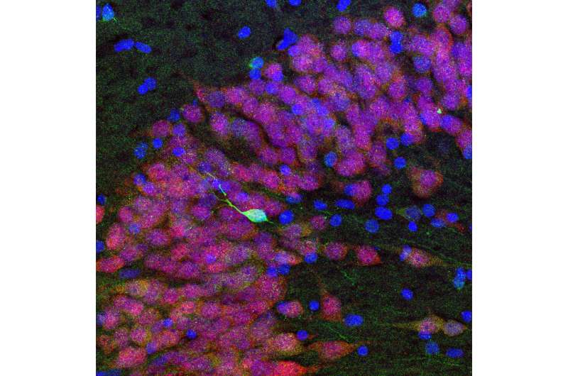 Adult human brains don't grow new neurons in hippocampus, contrary to prevailing view