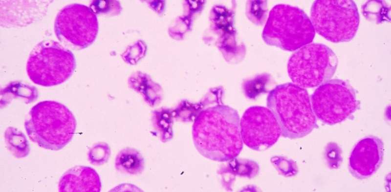 Adult leukaemia can be caused by gene implicated in breast cancer and obesity