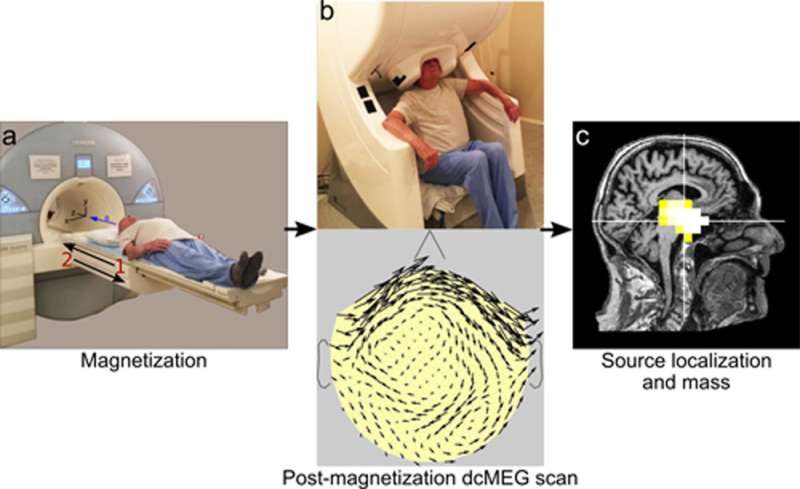 先进的成像技术措施磁铁矿含量住大脑