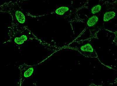 ALS-linked protein's journey into nervous system cells more complex than we thought