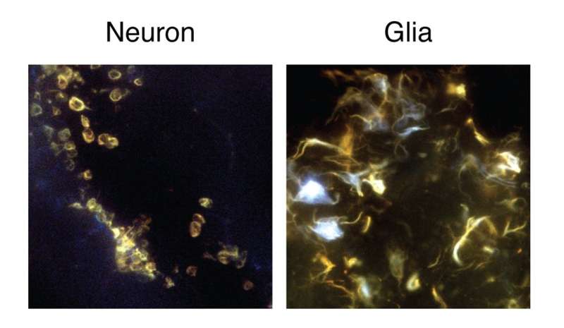 Alzheimer plaque affects different brain cells differently