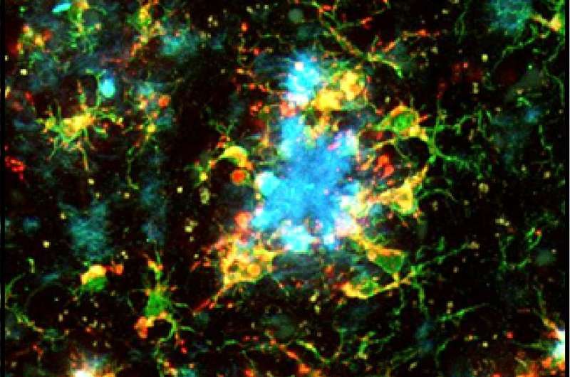 Alzheimer’s research—intracellular calcium store malfunction leads to brain hyperactivity