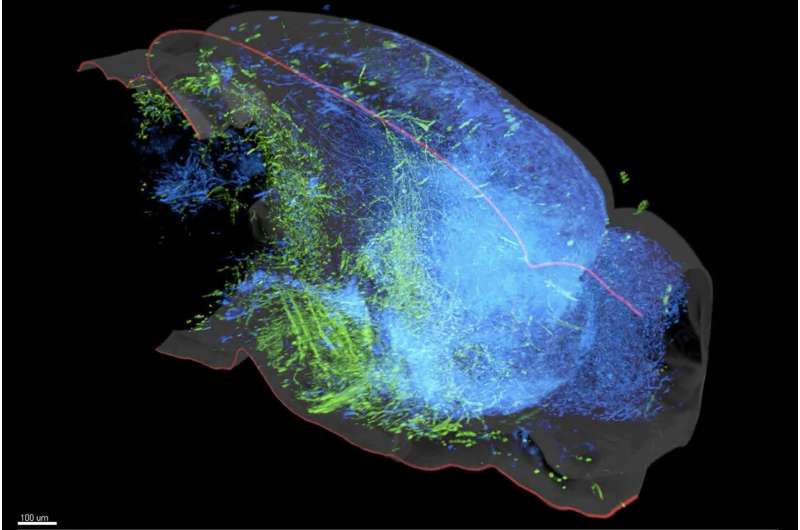 A new map of the brain’s serotonin system