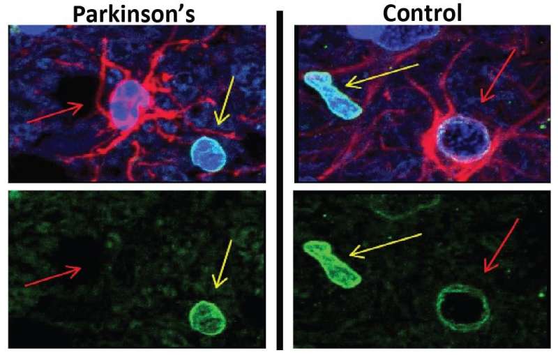 A new therapeutic avenue for Parkinson's disease