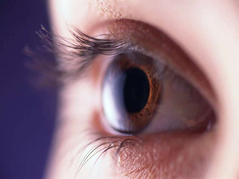 Better classification of dry eye disease will aid diagnosis, tx