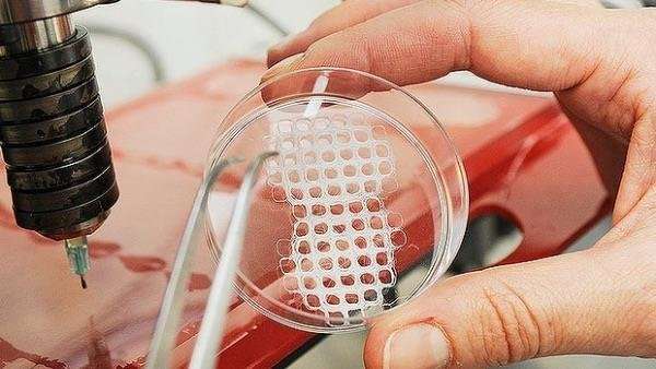Bioprinting bone substitute materials with cell-laden bioinks