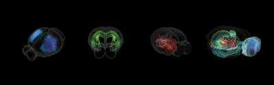 蓝脑计划发布首个数字3D脑细胞图谱