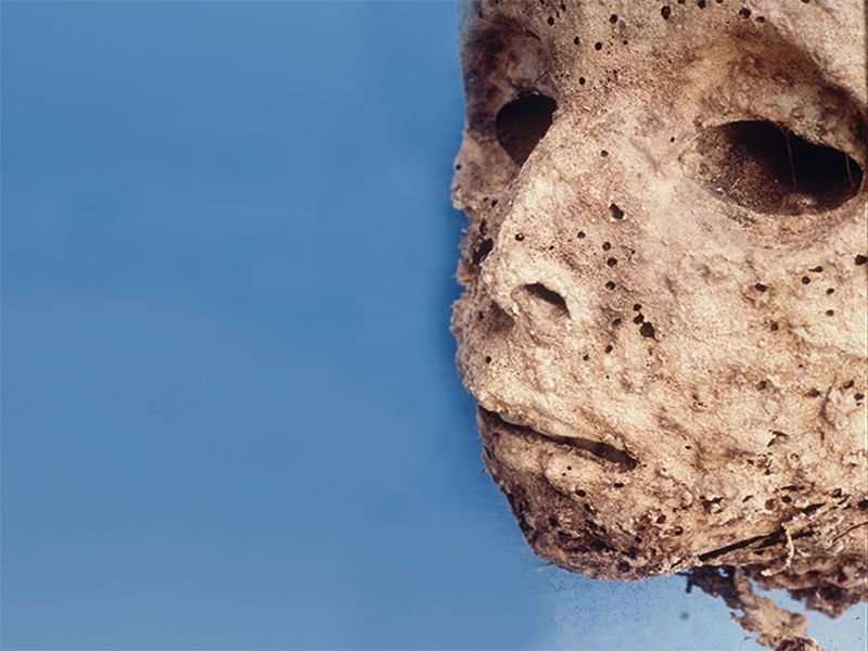 Boy who died 450 years ago gives clues to hepatitis research