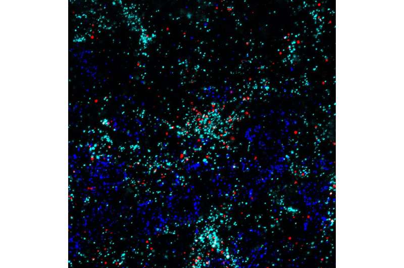 Brain cells called astrocytes have unexpected role in brain 'plasticity'
