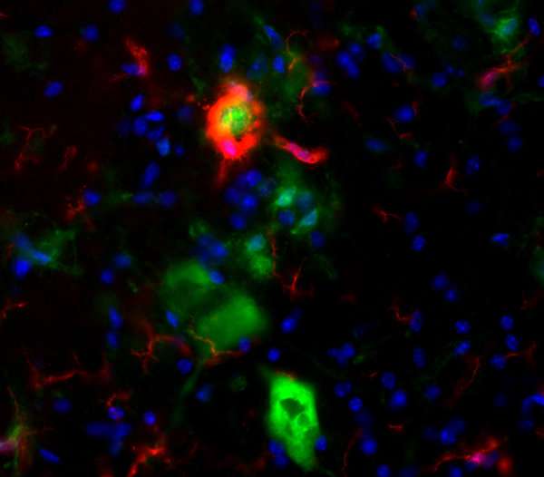 Brain immune system is key to recovery from motor neuron degeneration