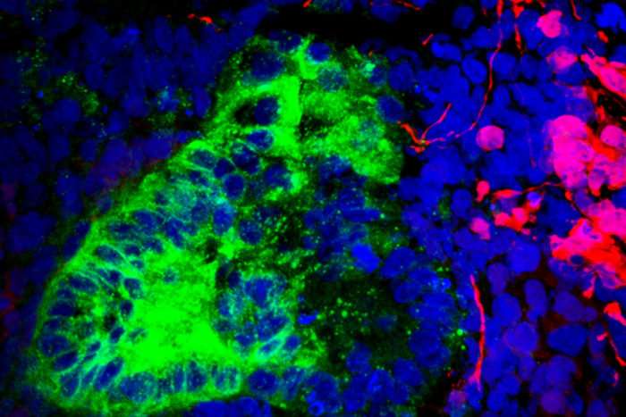 Brain, muscle cells found lurking in kidney organoids grown in lab