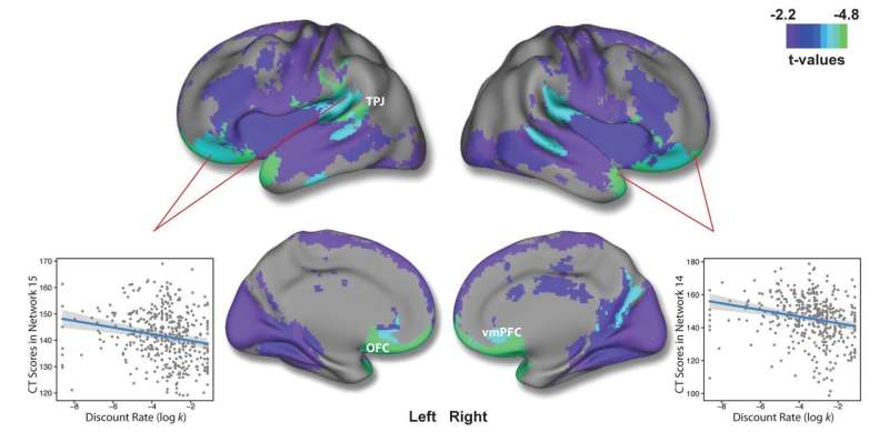 Brain thickness provides insight into teenage decision-making