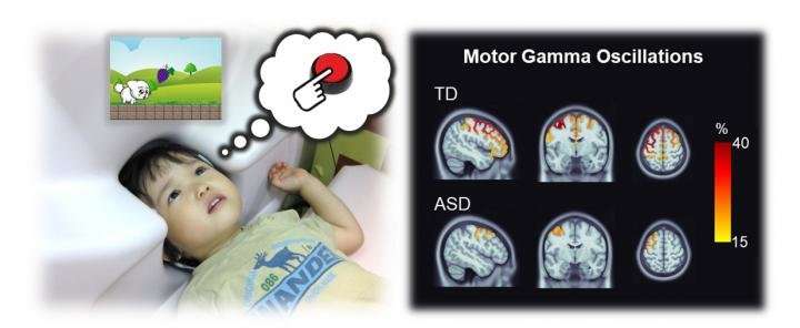 Brainwave activity reveals potential biomarker for autism in children