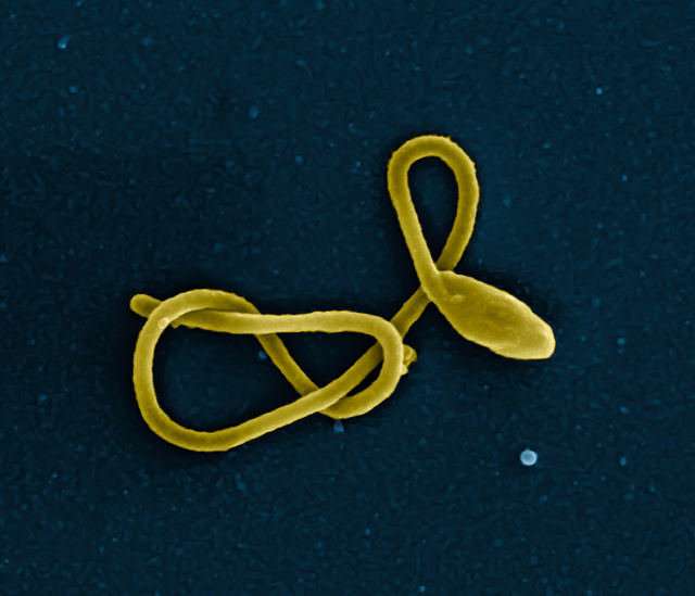 埃博拉幸存者血浆中发现的具有广泛作用的抗体