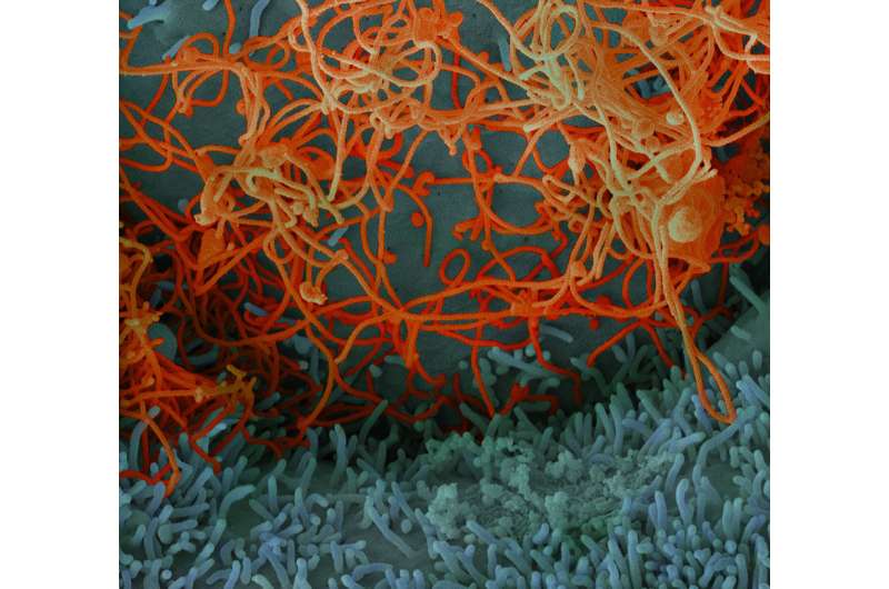 BU study: Diagnosing Ebola before symptoms arrive