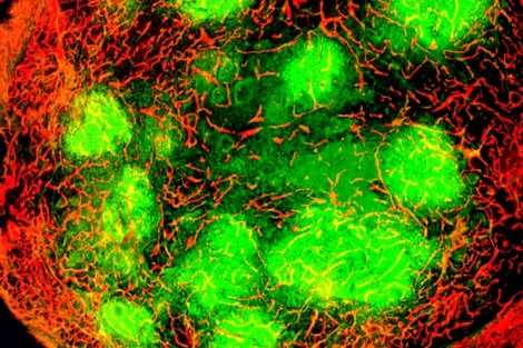 Cancer-killing virus acts by alerting immune system