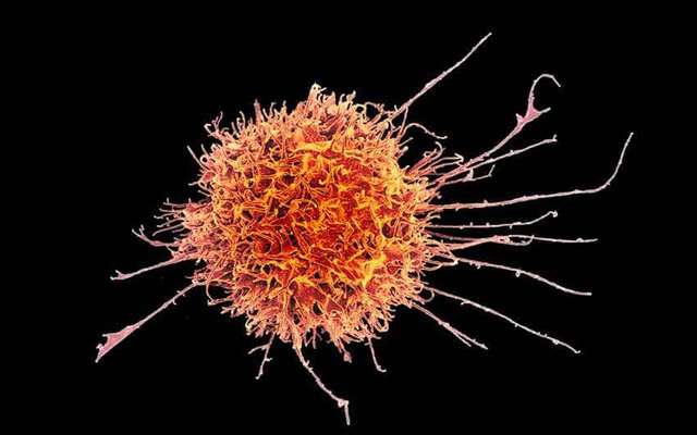 CAR-T immunotherapies may have a new player
