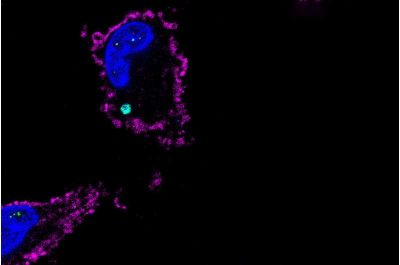 Cell death protein also damps inflammation