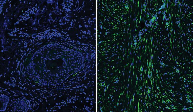 Cells beneath the skin explain differences in healing