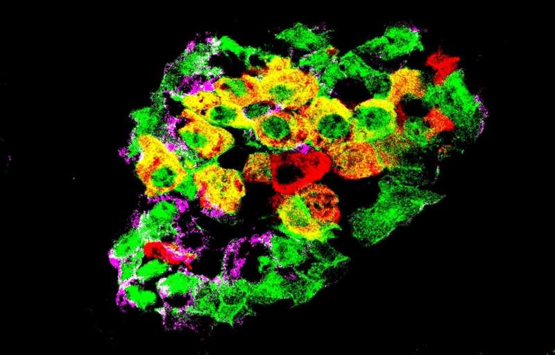 Cells that change jobs to fight diabetes