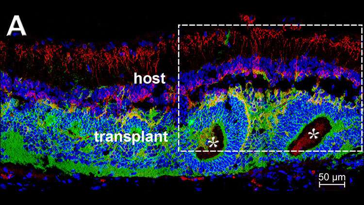 Cell transplant restores vision in rats