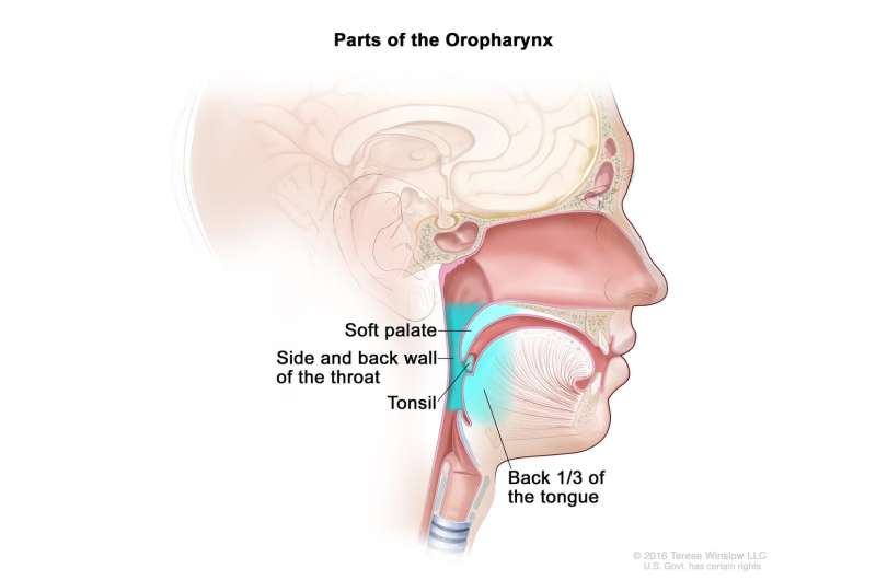 Cetuximab+RT found to be inferior to standard treatment in HPV+ oropharyngeal cancer